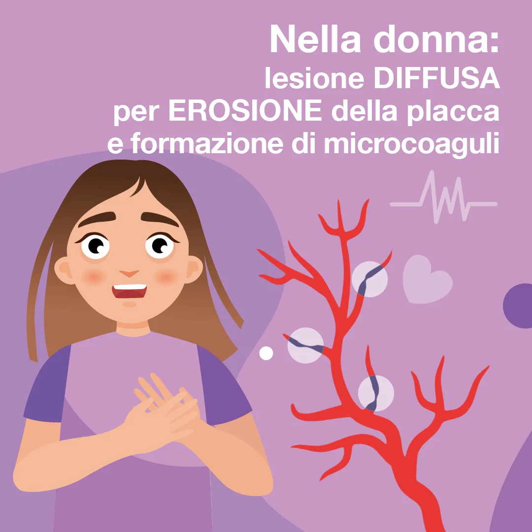Carosello_4 1080px Cardio_Isch-3